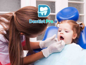 فلوراید تراپی پیشگیرانه کودکان
