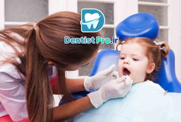 فلوراید تراپی پیشگیرانه کودکان