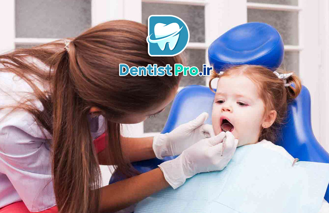 فلوراید تراپی پیشگیرانه کودکان