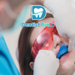 فلوراید تراپی پیشگیرانه: کلید سلامت دندان‌ها