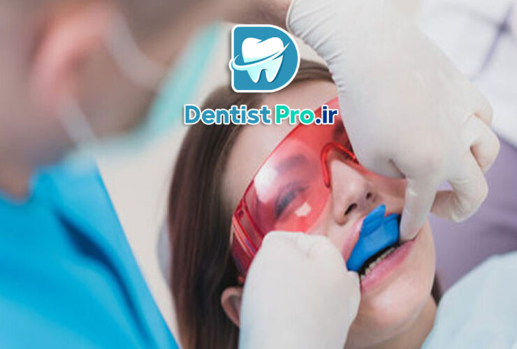 فلوراید تراپی پیشگیرانه: کلید سلامت دندان‌ها