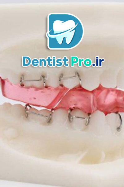 همه چیز در مورد ارتودنسی پیشگیرانه فانکشنال در سنین رشد