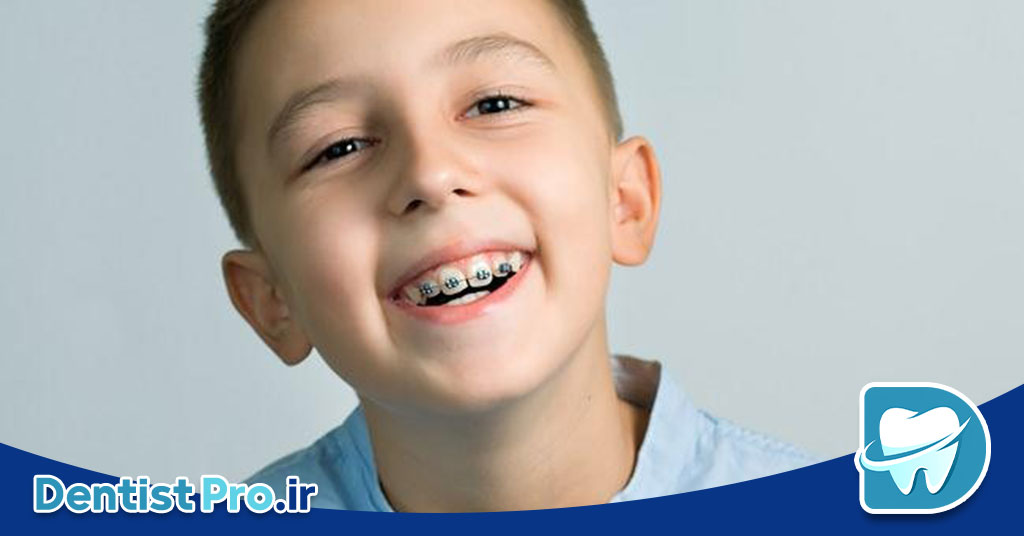 ارتودنسی پیشگیری در کودکان: کلیدی برای سلامت دهان و دندان در آینده