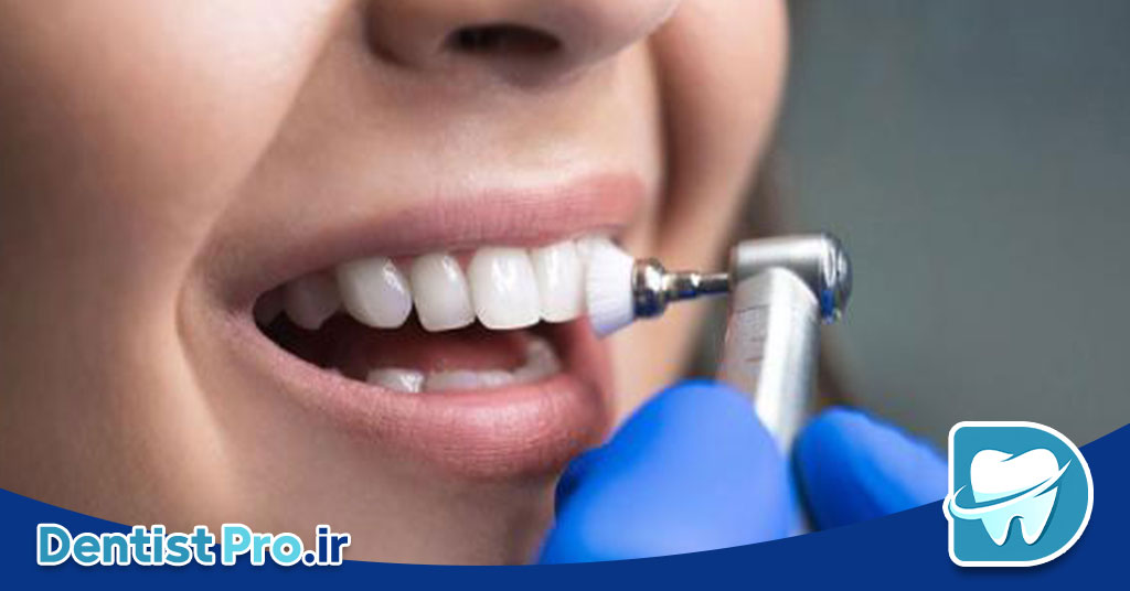 پوشش محافظ مینای دندان: راز حفظ سلامت و زیبایی دندانها 26 پوشش محافظ مینای دندان: راز حفظ سلامت و زیبایی دندانها