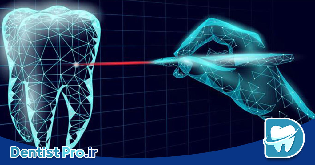 ترمیم ریشه با فیلرهای بیولوژیک نانومتری: نوآوری در درمانهای اندودنتیک 26 ترمیم ریشه با فیلرهای بیولوژیک نانومتری: نوآوری در درمانهای اندودنتیک