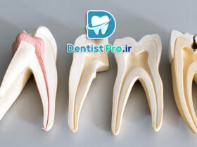 ترمیم ریشه با فیلرهای بیولوژیک نانومتری: نوآوری در درمان‌های اندودنتیک