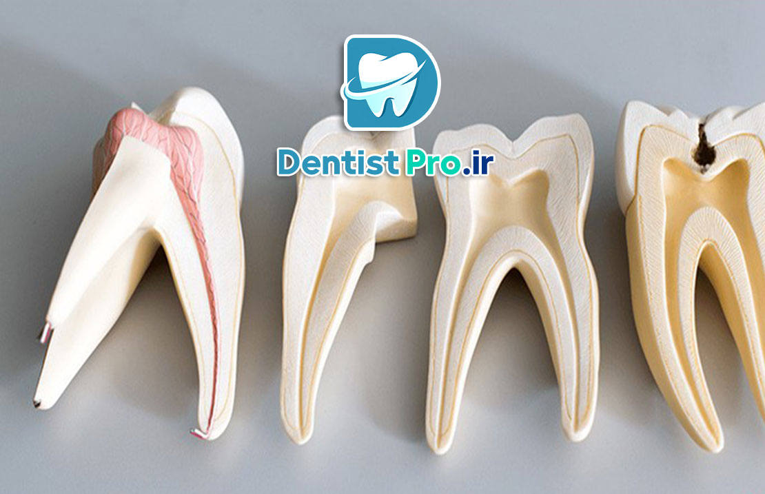 ترمیم ریشه با فیلرهای بیولوژیک نانومتری: نوآوری در درمانهای اندودنتیک 25 ترمیم ریشه با فیلرهای بیولوژیک نانومتری: نوآوری در درمانهای اندودنتیک