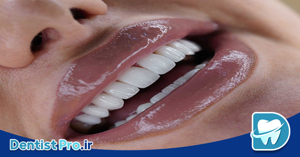 طراحی لبخند با هوش مصنوعی و اسکن 3D دقیق: آینده دندانپزشکی زیبایی