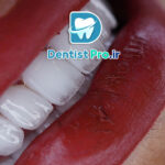 طراحی لبخند با هوش مصنوعی و اسکن 3D دقیق: آینده دندانپزشکی زیبایی