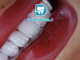 طراحی لبخند با هوش مصنوعی و اسکن 3D دقیق: آینده دندانپزشکی زیبایی