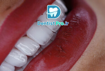 طراحی لبخند با هوش مصنوعی و اسکن 3D دقیق: آینده دندانپزشکی زیبایی