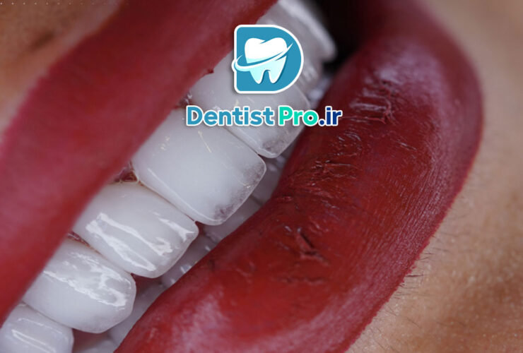 طراحی لبخند با هوش مصنوعی و اسکن 3D دقیق: آینده دندانپزشکی زیبایی 39 طراحی لبخند با هوش مصنوعی و اسکن 3D دقیق: آینده دندانپزشکی زیبایی