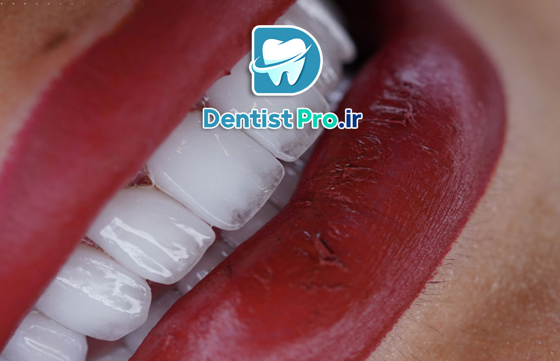 طراحی لبخند با هوش مصنوعی و اسکن 3D دقیق: آینده دندانپزشکی زیبایی