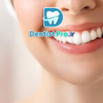 بلیچینگ تخصصی در کلینیک: راهنمای جامع سفید کردن دندان‌ها