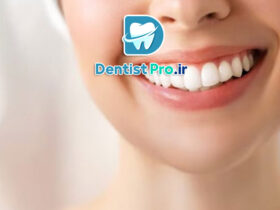بلیچینگ تخصصی در کلینیک: راهنمای جامع سفید کردن دندان‌ها
