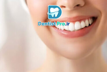 بلیچینگ تخصصی در کلینیک: راهنمای جامع سفید کردن دندان‌ها