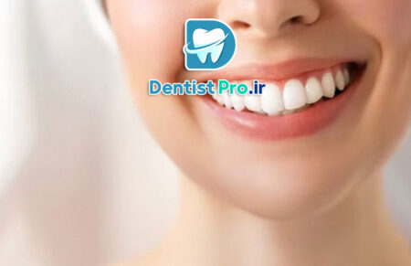 بلیچینگ تخصصی در کلینیک: راهنمای جامع سفید کردن دندان‌ها