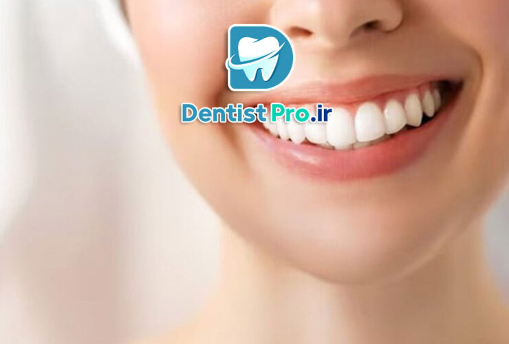 بلیچینگ تخصصی در کلینیک: راهنمای جامع سفید کردن دندان‌ها