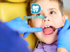 پروتز موقت مخصوص کودکان با دندان از دست رفته: راهکاری کارآمد در دندانپزشکی کودکان