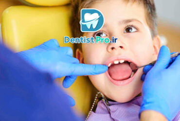 پروتز موقت مخصوص کودکان با دندان از دست رفته: راهکاری کارآمد در دندانپزشکی کودکان