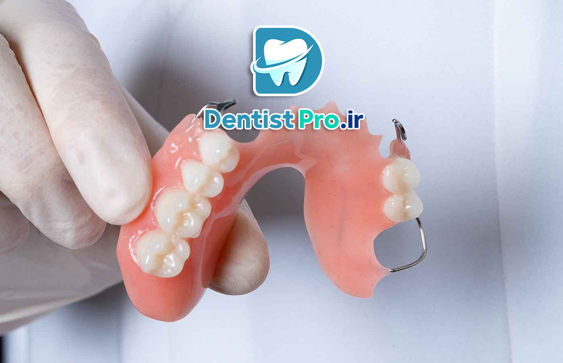 پروتز پارسیل موقت با قالب گیری دیجیتال در کودکان: نوآوری در درمانهای دندانپزشکی کودکان 25 پروتز پارسیل موقت با قالب گیری دیجیتال در کودکان: نوآوری در درمانهای دندانپزشکی کودکان