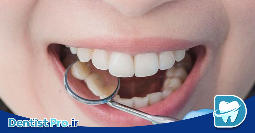 بازسازی مینای دندان با میکروابریژن: روشی نوین در دندانپزشکی ترمیمی