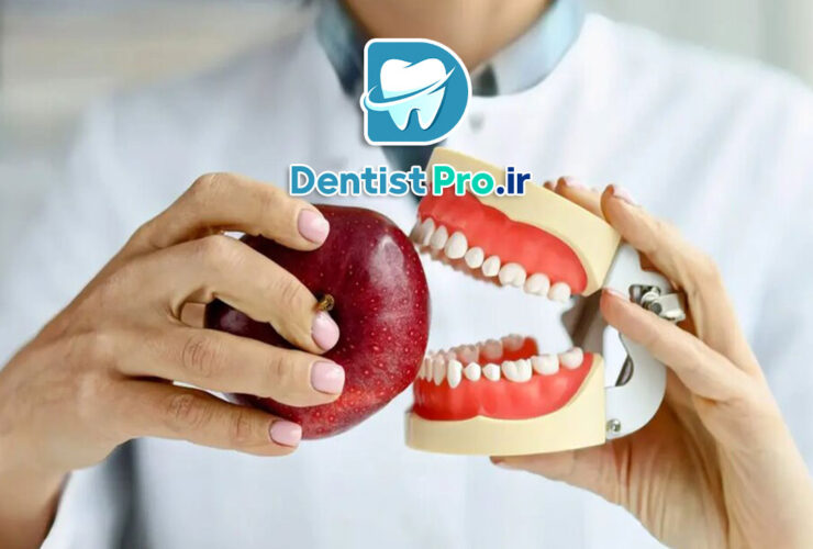 ترمیم مینای دندان به روش نانو هیبرید: نوآوری در دندانپزشکی مدرن 31 ترمیم مینای دندان به روش نانو هیبرید: نوآوری در دندانپزشکی مدرن