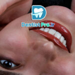 اصلاح شکل دندان با اورلپ لمینت چگونه است؟