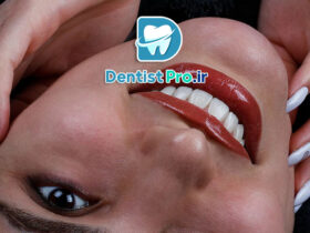 اصلاح شکل دندان با اورلپ لمینت چگونه است؟