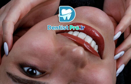 اصلاح شکل دندان با اورلپ لمینت چگونه است؟