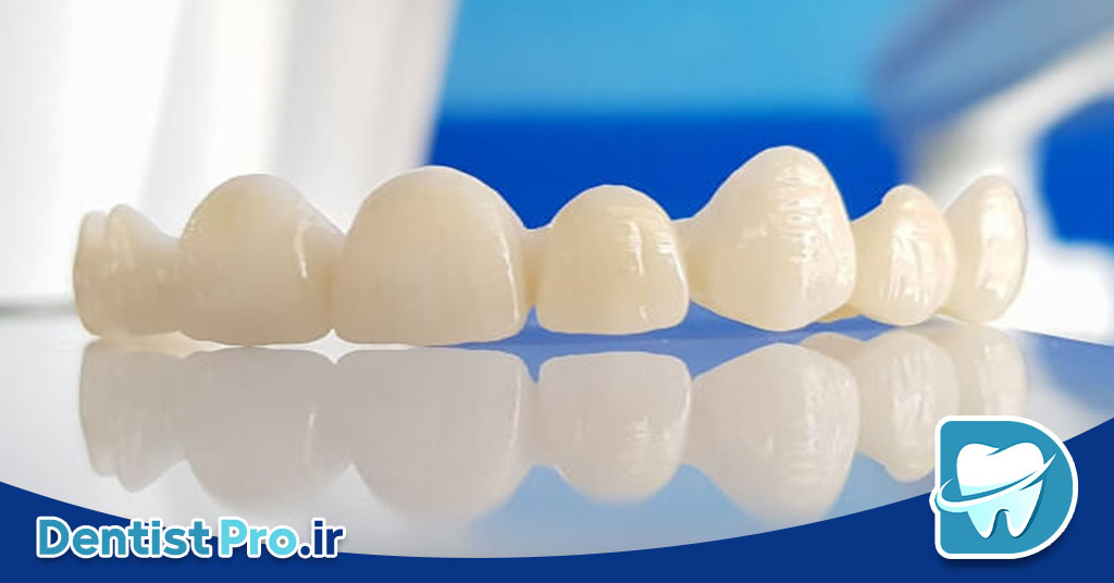 روکش زیرکونیوم شفاف: تحولی در دندانپزشکی زیبایی