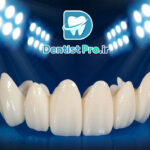 روکش زیرکونیوم شفاف: تحولی در دندانپزشکی زیبایی