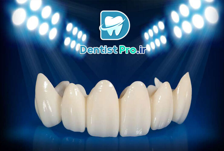 روکش زیرکونیوم شفاف: تحولی در دندانپزشکی زیبایی