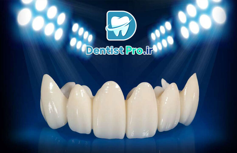 روکش زیرکونیوم شفاف: تحولی در دندانپزشکی زیبایی