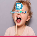 درمان پوسیدگی اولیه دندان های شیری: کلید سلامت دهان کودکان