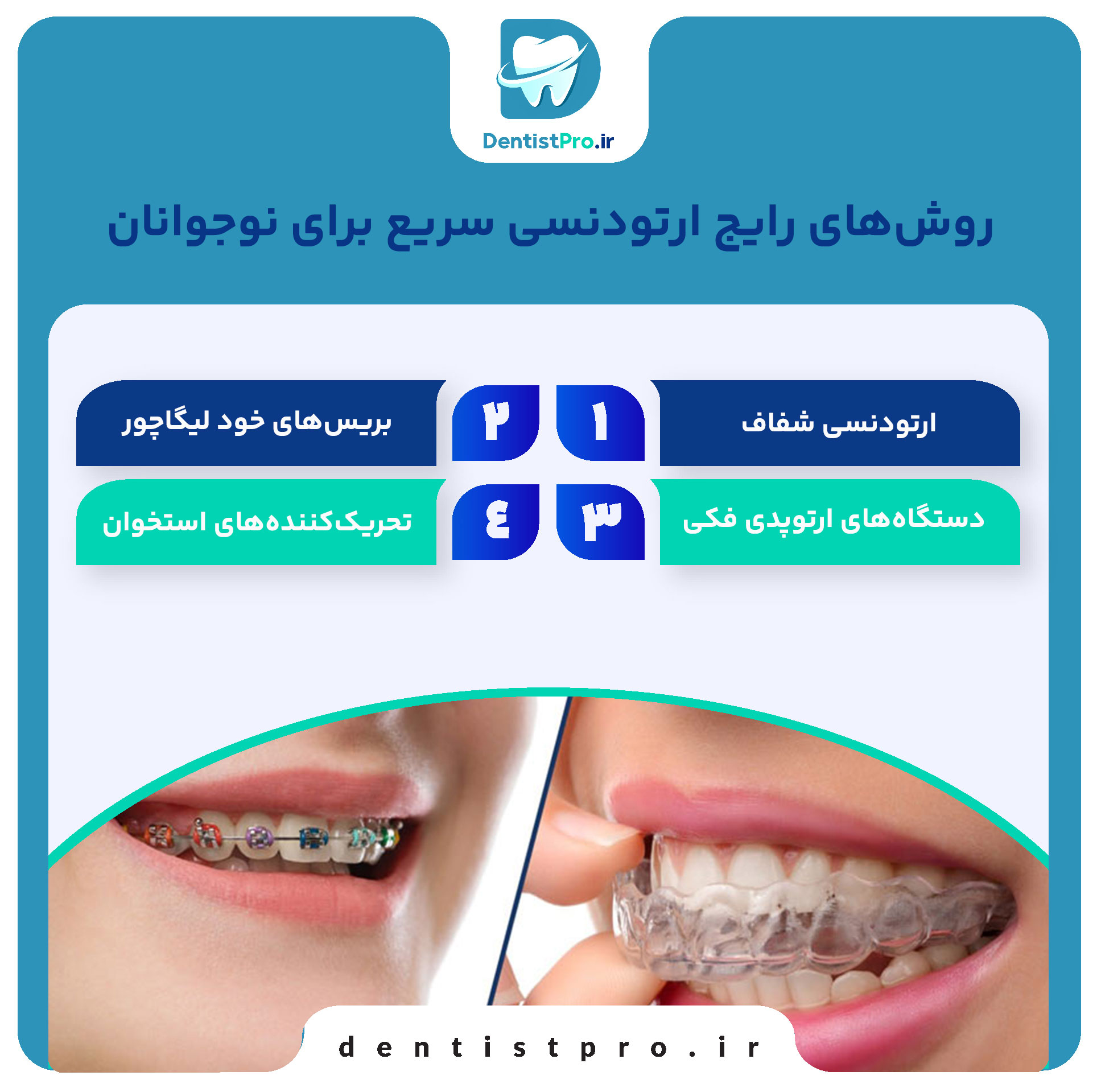 ارتودنسی سریع برای نوجوانان
