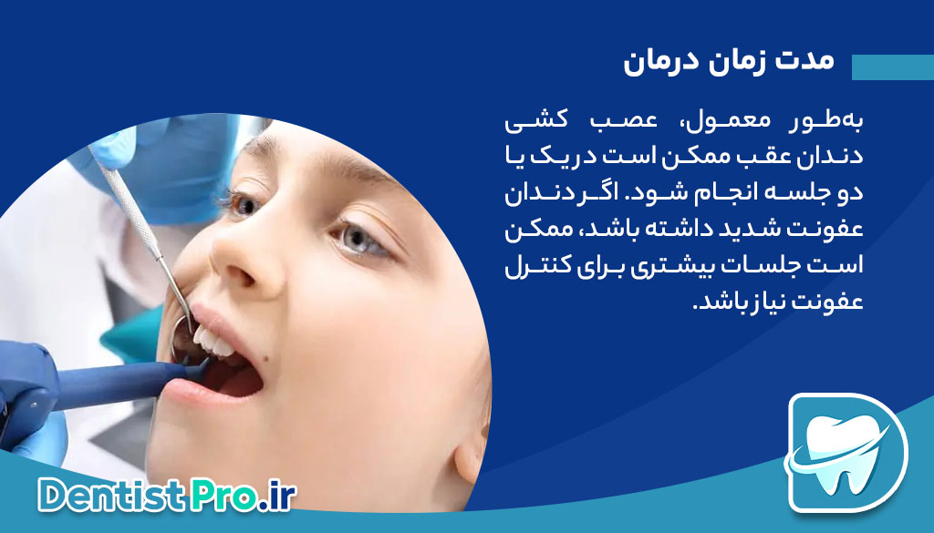 عصب کشی دندان عقب+مراحل آن چیست؟