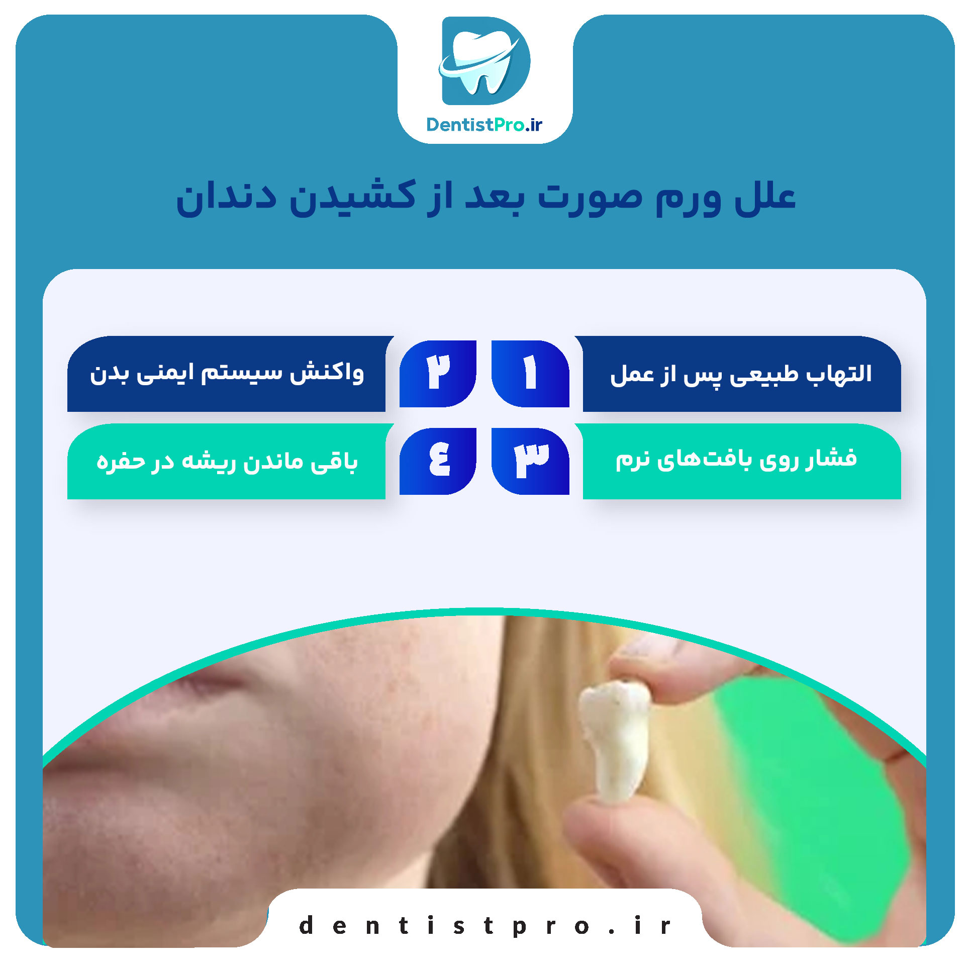 ورم صورت بعد از کشیدن دندان+ 5 راهکار موثر