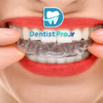 ارتودنسی شفاف بدون دیده شدن براکت ها در لبخند: راهنمای کامل برای لبخند زیبا
