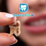 برنامه کامل مراقبت از دندان برای جلوگیری از پوسیدگی