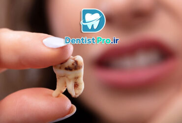 برنامه کامل مراقبت از دندان برای جلوگیری از پوسیدگی