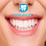 اصلاح خط لبخند ناهماهنگ بدون ارتودنسی