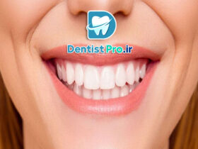 اصلاح خط لبخند ناهماهنگ بدون ارتودنسی