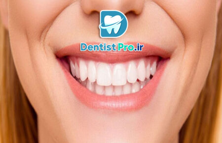 اصلاح خط لبخند ناهماهنگ بدون ارتودنسی