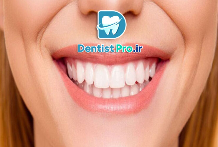 اصلاح خط لبخند ناهماهنگ بدون ارتودنسی 31 اصلاح خط لبخند ناهماهنگ بدون ارتودنسی