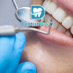 هزینه و مراحل معاینه کامل دندان برای اولین بار