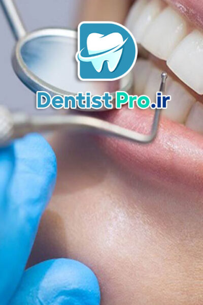 هزینه و مراحل معاینه کامل دندان برای اولین بار