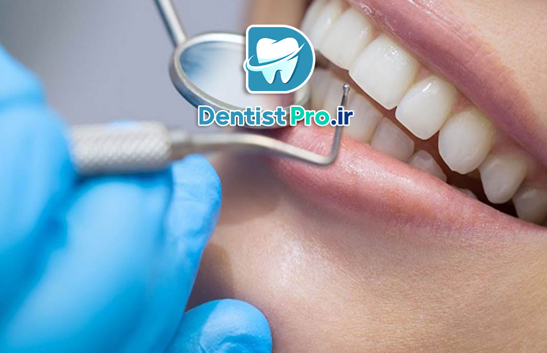 هزینه و مراحل معاینه کامل دندان برای اولین بار