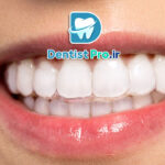 هزینه ارتودنسی نامرئی اینویزیلاین چقدر است؟