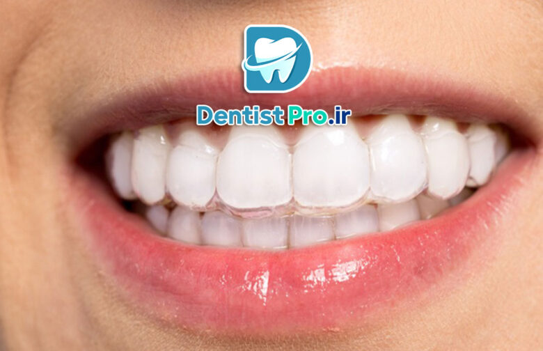 هزینه ارتودنسی نامرئی اینویزیلاین چقدر است؟